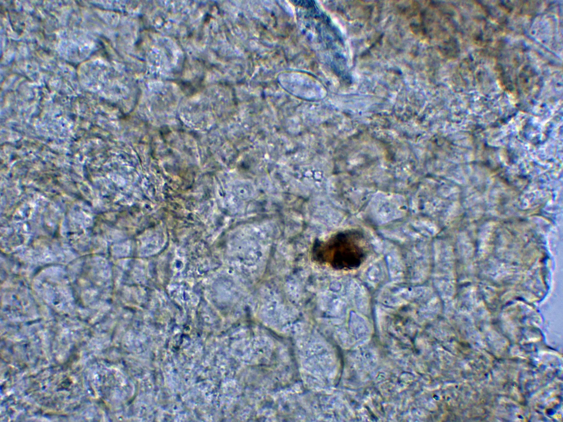 Microscopía de Ascobolus crenulatus - 10 - Excípulo ectal agua-002